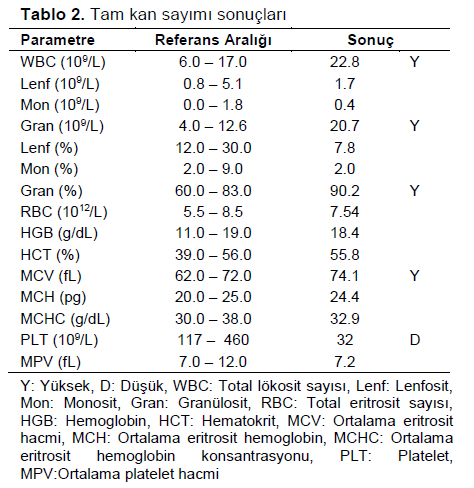Table 2